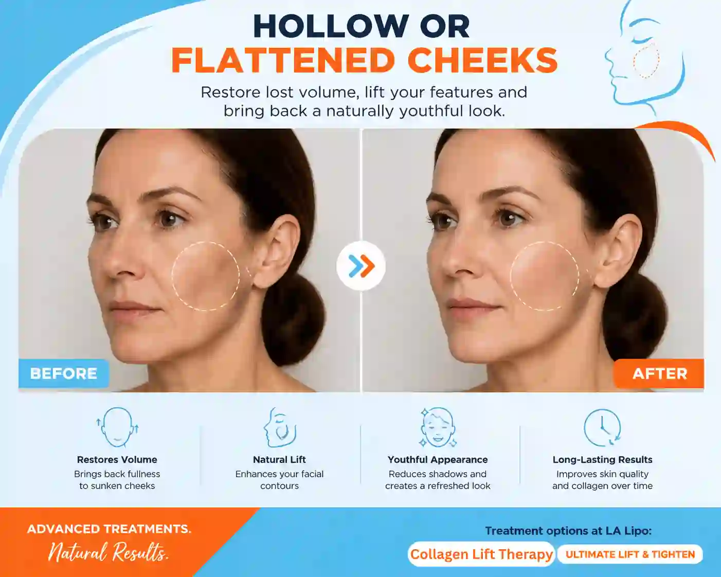 Sign #4: Hollow or Flattened Cheeks Broxburn