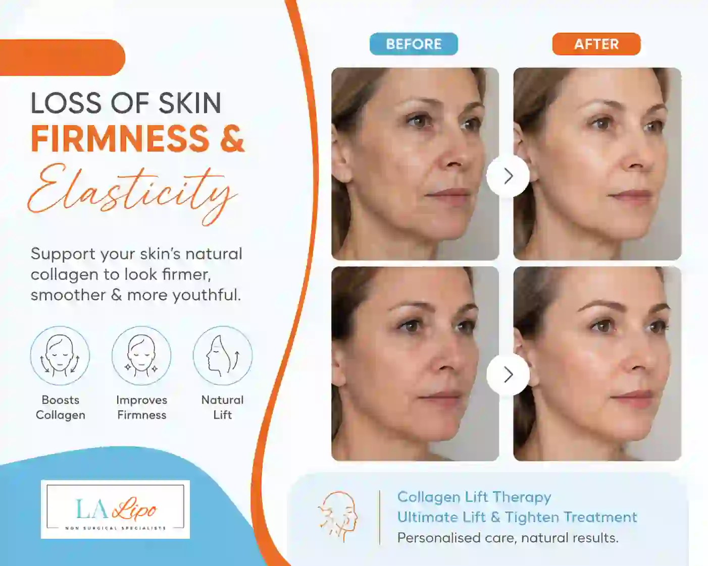 Sign #7: Loss of Skin Firmness and Elasticity Broxburn