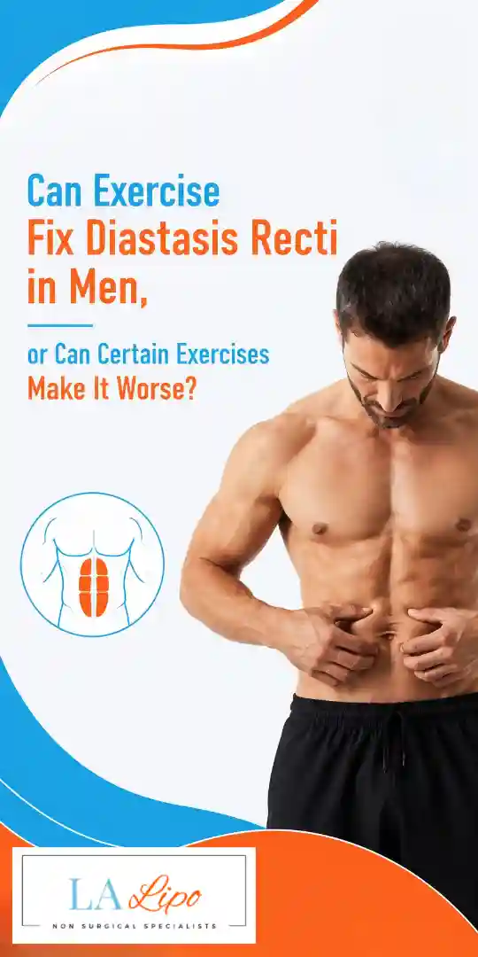 Can Exercise Fix Diastasis Recti in Men, or Can Certain Exercises Make It Worse Broxburn?