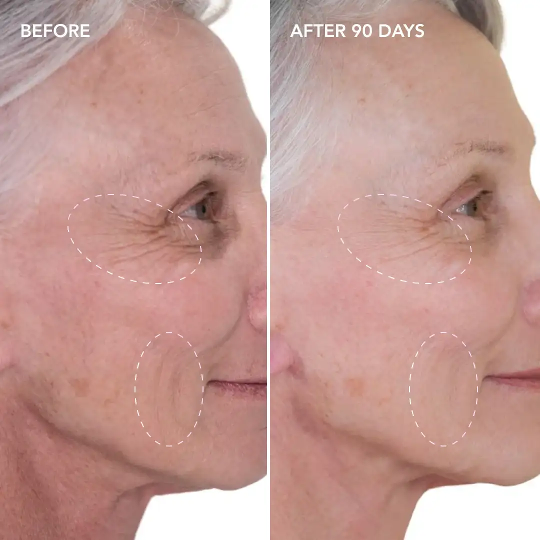When will you see results Broxburn